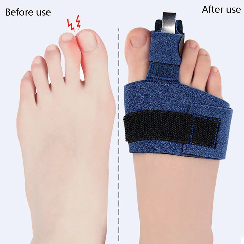 Orthèse doigt de pied