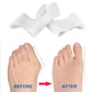 Orthèse orteil souple et discrète pour Hallux Valgus