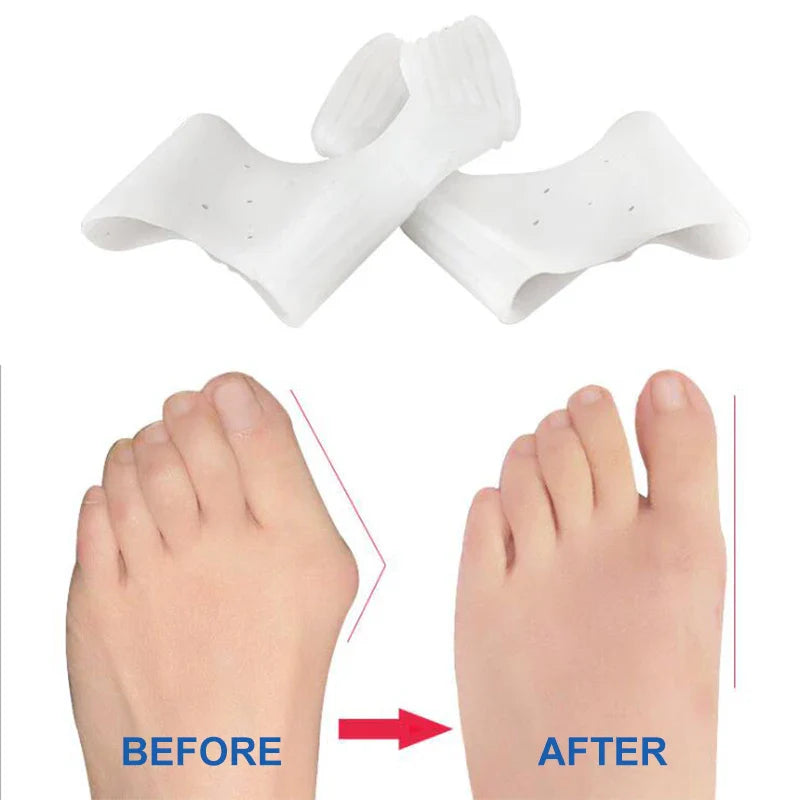 Orthèse orteil souple et discrète pour Hallux Valgus