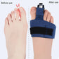 Orthèse doigt de pied
